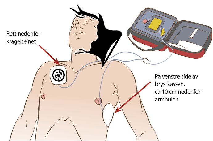 standard_Elektrodeplasseringewrg